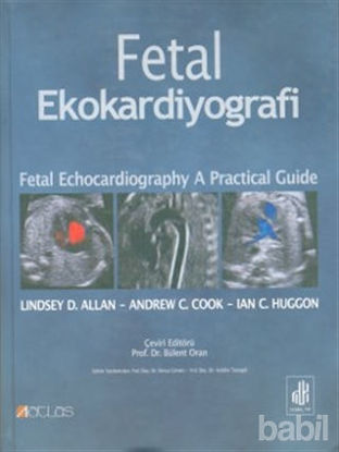 Picture of Fetal Ekokardiyografi