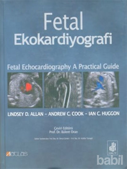 Picture of Fetal Ekokardiyografi