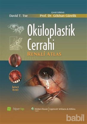 Picture of Oküloplastik Cerrahi