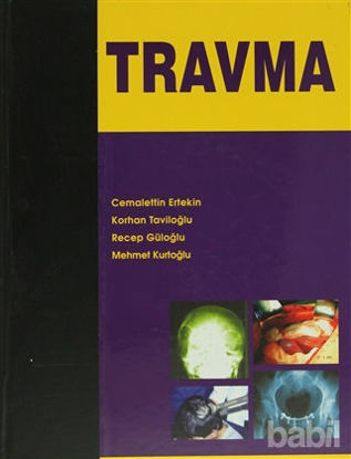 Picture of Travma