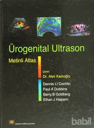 Picture of Ürogenital Ultrason