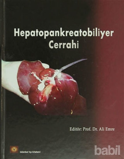 Picture of Hepatopankreatobiliyer Cerrahi
