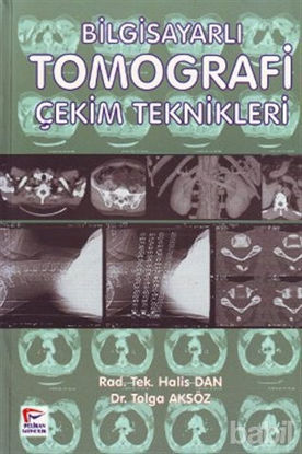 Picture of Bilgisayarlı Tomografi Çekim Teknikleri
