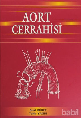 Picture of Aort Cerrahisi