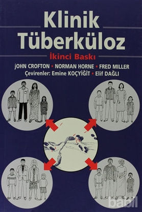 Picture of Klinik Tüberküloz