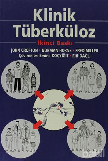 Picture of Klinik Tüberküloz