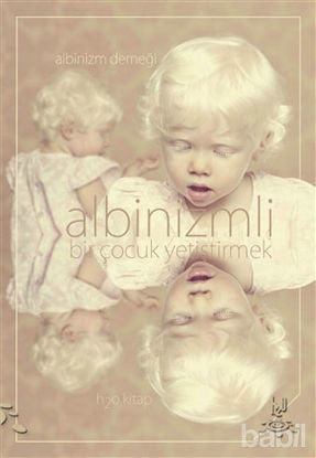 Picture of Albinizmli Bir Çocuk Yetiştirmek