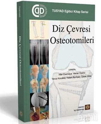 Picture of Diz Çevresi Osteotomileri