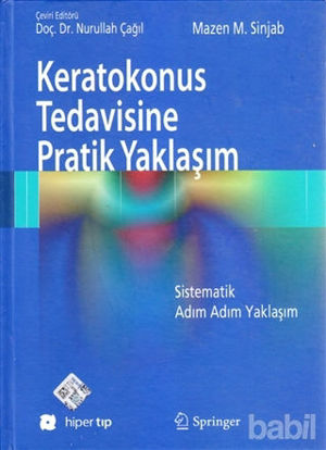 Picture of Keratokonus Tedavisine Pratik Yaklaşım