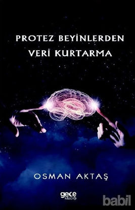 Picture of Protez Beyinlerden Veri Kurtarma