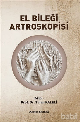 Picture of El Bileği Artroskopisi