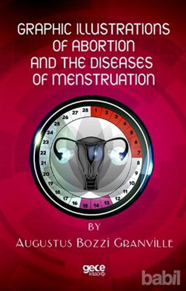 Picture of Graphic Illustrations Of Abortion And The Diseases Of Menstruation
